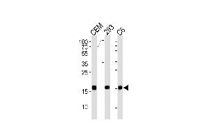 SUMO2 Antibody (C-term) (ABIN1882280 and ABIN2843489) western blot analysis in CEM,293,rat C6 cell line lysates (35 μg/lane). (SUMO2 anticorps)