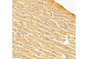 Immunohistochemistry of paraffin embedded rat heart using Igfn1 (ABIN7074278) at dilution of 1:700 (400x lens)
