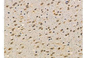 ABIN7095401 and ABIN7099458 at 1/100 staining mouse brain tissue by IHC-P.