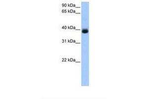 Image no. 1 for anti-serpin Peptidase Inhibitor, Clade A (Alpha-1 Antiproteinase, Antitrypsin), Member 5 (SERPINA5) (AA 269-318) antibody (ABIN6738847)