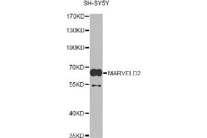 Western blot analysis of extracts of SH-SY5Y cells, using MARVELD2 antibody. (Tricellulin anticorps)