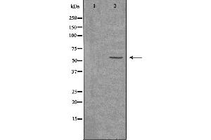 Western blot analysis of extracts from K562 cells, using ACVL1 antibody. (ACVRL1 anticorps  (Internal Region))