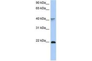 Image no. 1 for anti-Distal-Less Homeobox 4 (DLX4) (C-Term) antibody (ABIN6742745) (DLX4 anticorps  (C-Term))