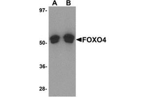 Western blot analysis of FOXO4 in A-20 cell lysate with FOXO4 antibody at (A) 0. (FOXO4 anticorps  (N-Term))