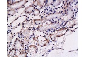 Formalin-fixed and paraffin embedded: rat kidney tissue labeled with Anti-ET-1 Polyclonal Antibody , Unconjugated at 1:200, followed by conjugation to the secondary antibody and DAB staining (Prepro-Endothelin-1 (AA 16-110) anticorps)