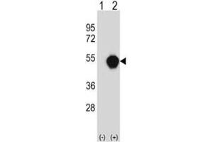 Western blot analysis of PXK antibody and 293 cell lysate (2 ug/lane) either nontransfected (Lane 1) or transiently transfected (2) with the PXK gene. (PXK anticorps  (AA 221-251))