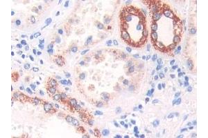 Detection of Hsp60 in Human Kidney Tissue using Polyclonal Antibody to Heat Shock Protein 60 (Hsp60)