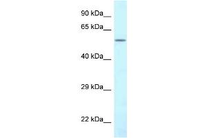WB Suggested Anti-CTPS2 Antibody Titration: 1. (CTPS2 anticorps  (N-Term))