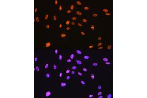 Immunofluorescence analysis of C6 cells using SFPQ Rabbit mAb (ABIN7270547) at dilution of 1:100 (40x lens).