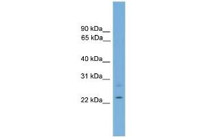 WB Suggested Anti-RBM11 Antibody Titration:  0. (RBM11 anticorps  (Middle Region))