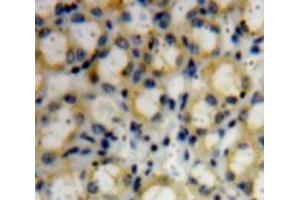 IHC-P analysis of Kidney tissue, with DAB staining. (COL4a3 anticorps  (AA 1428-1670))