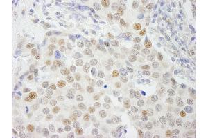 Immunohistochemistry (IHC) image for anti-General Transcription Factor IIIC, Polypeptide 4 (GTF3C4) (AA 625-675) antibody (ABIN7448587)
