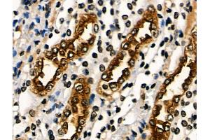 ABIN6265563 and ABIN6266644 at 1/100 staining Rat kidney tissue by IHC-P. (PAR1 anticorps  (N-Term))