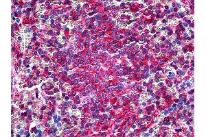 Anti-L Plastin antibody IHC of human spleen. (LCP1 anticorps  (Headpiece Region))