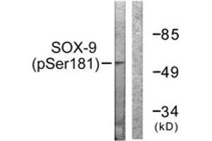 Western blot analysis of extracts from 293 cells treated with PBS 60', using SOX-9 (Phospho-Ser181) Antibody. (SOX9 anticorps  (pSer181))