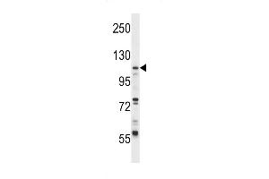 Western blot analysis in CEM cell line lysates (35ug/lane).