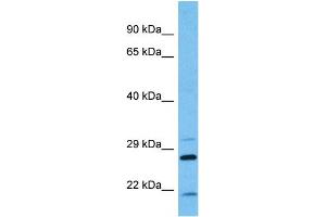 Host:  Mouse  Target Name:  KCNIP2  Sample Tissue:  Mouse Pancreas  Antibody Dilution:  1ug/ml (KCNIP2 anticorps  (N-Term))