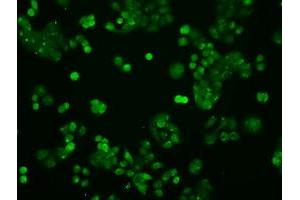 Image no. 7 for anti-Signal Transducer and Activator of Transcription 1, 91kDa (STAT1) antibody (ABIN1501169) (STAT1 anticorps)