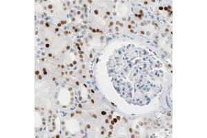 Immunohistochemical staining (Formalin-fixed paraffin-embedded sections) of human kidney with HNF1B monoclonal antibody, clone CL0374  shows moderate to strong nuclear immunoreactivity in renal tubules.