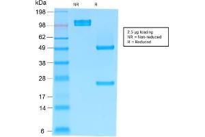 anti-Immunoglobulin Heavy Constant mu (IGHM) antibody
