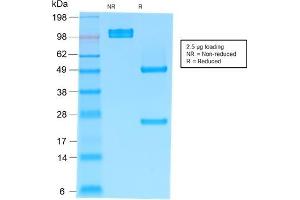 SDS-PAGE Analysis Purified IgM Mouse Recombinant Monoclonal Antibody (rIM373). (Recombinant IGHM anticorps)