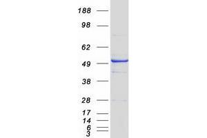 Validation with Western Blot
