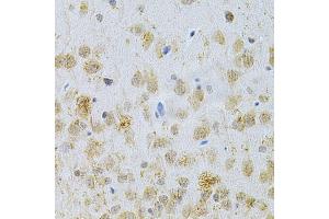Immunohistochemistry of paraffin-embedded rat brain using MAP2 Antibody (ABIN1873602) at dilution of 1:200 (40x lens). (MAP2 anticorps)