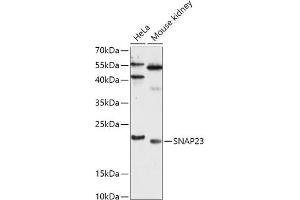 Western blot analysis of extracts of various cell lines, using SN antibody (ABIN7270670) at 1:1000 dilution. (SNAP23 anticorps  (AA 1-211))