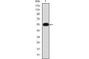 Western blot analysis using MMP9 mAb against human MMP9 (AA: 238-465) recombinant protein.