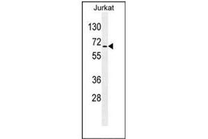 Western blot analysis of RBM14 Antibody (C-term) in Jurkat cell line lysates (35ug/lane). (RBM14 anticorps  (C-Term))