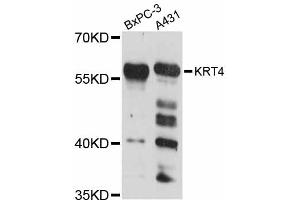 Western blot analysis of extracts of various cell lines, using KRT4 antibody (ABIN5998102) at 1:3000 dilution. (KRT4 anticorps)
