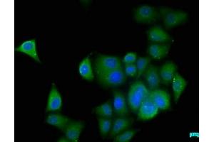 Immunofluorescence staining of Hela cells with ABIN7157186 at 1:50, counter-stained with DAPI. (KALRN anticorps  (AA 2410-2661))
