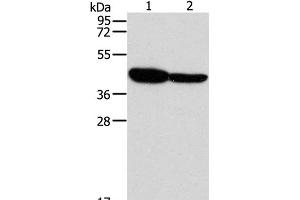 Western Blot analysis of Mouse brain and Human fetal brain tissue using GLRA1 Polyclonal Antibody at dilution of 1:500 (GLRA1 anticorps)