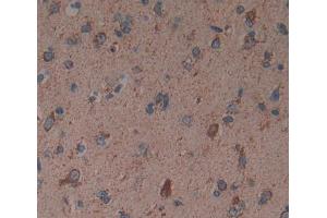 Used in DAB staining on fromalin fixed paraffin- embedded brain tissue