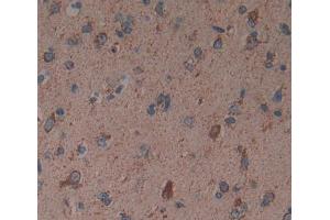 Used in DAB staining on fromalin fixed paraffin- embedded brain tissue (Reticulon 1 anticorps  (AA 589-776))