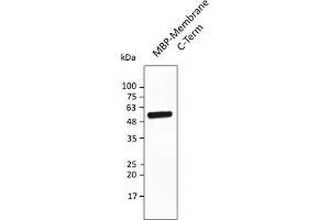 Western Blotting (WB) image for anti-SARS-CoV-2 Membrane Protein (SARS-CoV-2 M) (AA 150-215) antibody (ABIN7273018) (SARS-CoV-2 Membrane Protein anticorps  (AA 150-215))