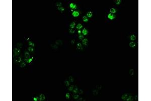 Immunofluorescence staining of PC3 cells with ABIN7155749 at 1:100, counter-stained with DAPI.