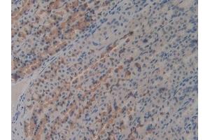 Detection of C7 in Rat Stomach Tissue using Polyclonal Antibody to Complement Component 7 (C7)