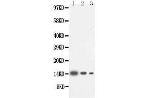 Anti-IL-4 antibody, Western blotting Lane 1: Recombinant Human IL-4 Protein 10ng Lane 2: Recombinant Human IL-4 Protein 5ng Lane 3: Recombinant Human IL-4 Protein 2. (IL-4 anticorps  (Middle Region))