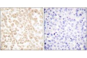 Immunohistochemistry (IHC) image for anti-FOS-Like Antigen 2 (FOSL2) (AA 271-320) antibody (ABIN2889199)