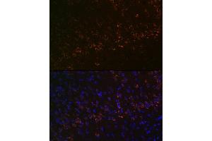 Immunofluorescence analysis of mouse brain using Huntingtin Rabbit mAb (ABIN7267793) at dilution of 1:100 (40x lens). (Huntingtin anticorps)