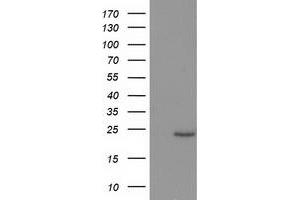 Western Blotting (WB) image for anti-Suppressor of Cytokine Signaling 3 (SOCS3) antibody (ABIN1501059) (SOCS3 anticorps)