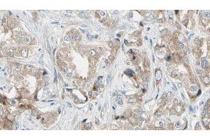 ABIN6279042 at 1/100 staining Human prostate tissue by IHC-P. (RPL24 anticorps  (Internal Region))