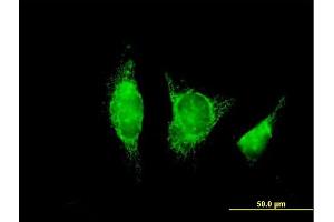 Immunofluorescence of purified MaxPab antibody to ADH1B on HeLa cell.