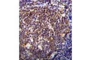 anti-Homeobox B6 (HOXB6) (AA 135-163), (Middle Region) antibody