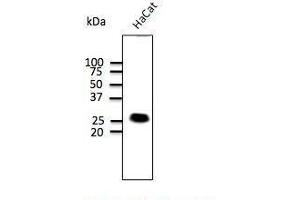 Anti-Calnexin Ab at 1/500 dilution, lysates at 50 per Iane, rabbit polyclonal to goat lµg (HRP) at 1/10,000 dilution, (Caveolin-1 anticorps  (N-Term))