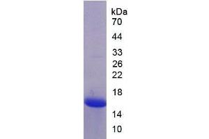 SDS-PAGE of Protein Standard from the Kit (Highly purified E. (MASP2 Kit ELISA)