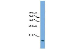 POP5 antibody used at 0. (POP5 anticorps  (Middle Region))