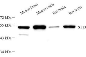 Western blot analysis of ST13 (ABIN7075761),at dilution of 1: 2000 (HSC70 Interacting Protein HIP anticorps)