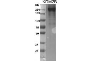 Recombinant FBXL10 / KDM2B protein gel.